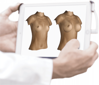 La simulation 3D, une nouvelle technologie au service de la chirurgie esthétique