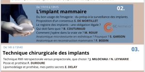 Le Dr Duroure a partagé son expertise sur la correction d'une ptose mammaire avec des implants mammaires.