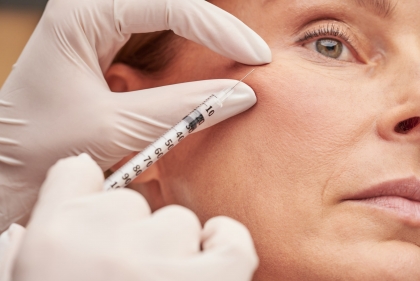 Les inducteurs tissulaires en médecine esthétique